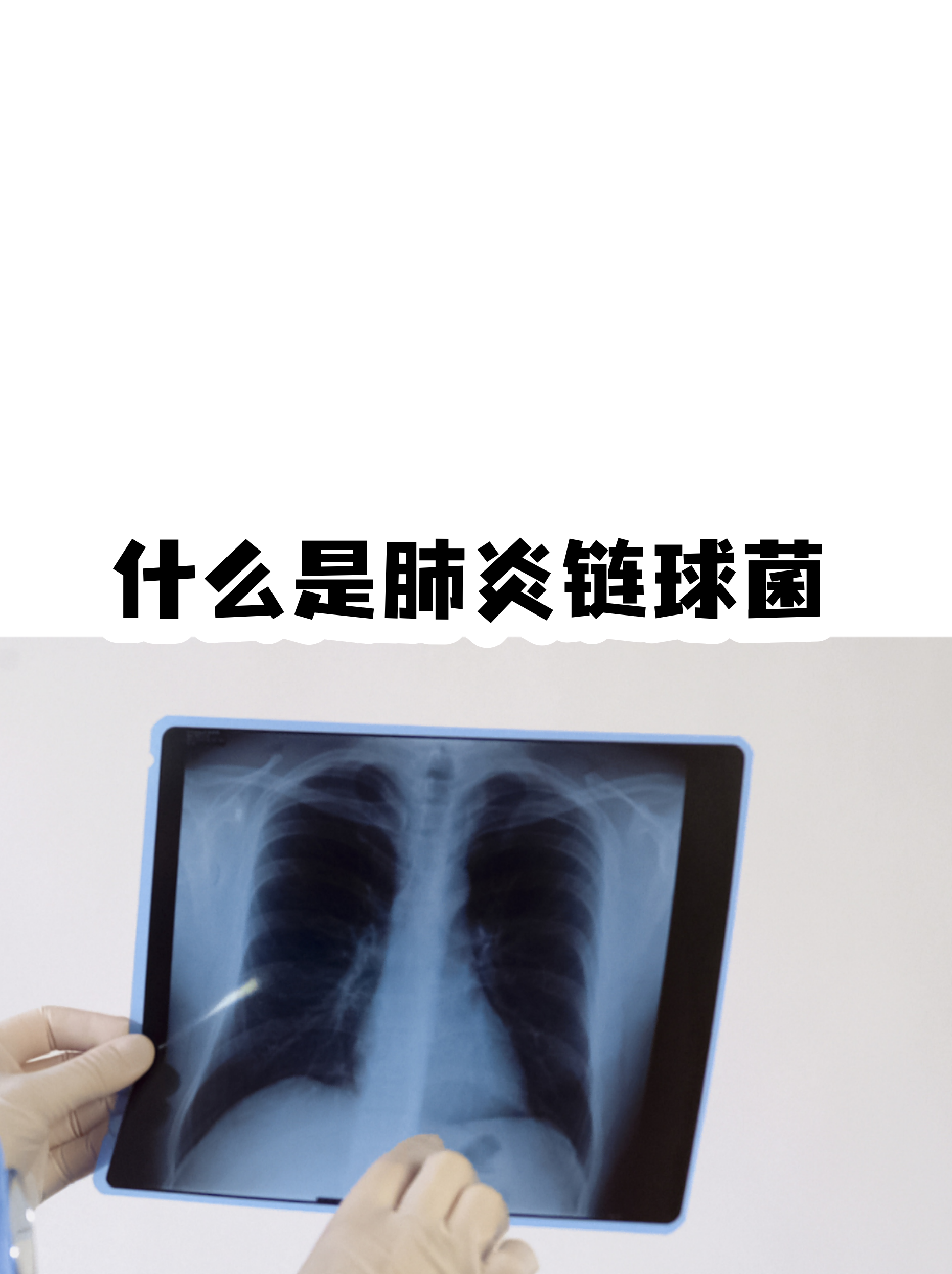 疫情造成的地区不和平.疫情中不和谐的现象？-第2张图片