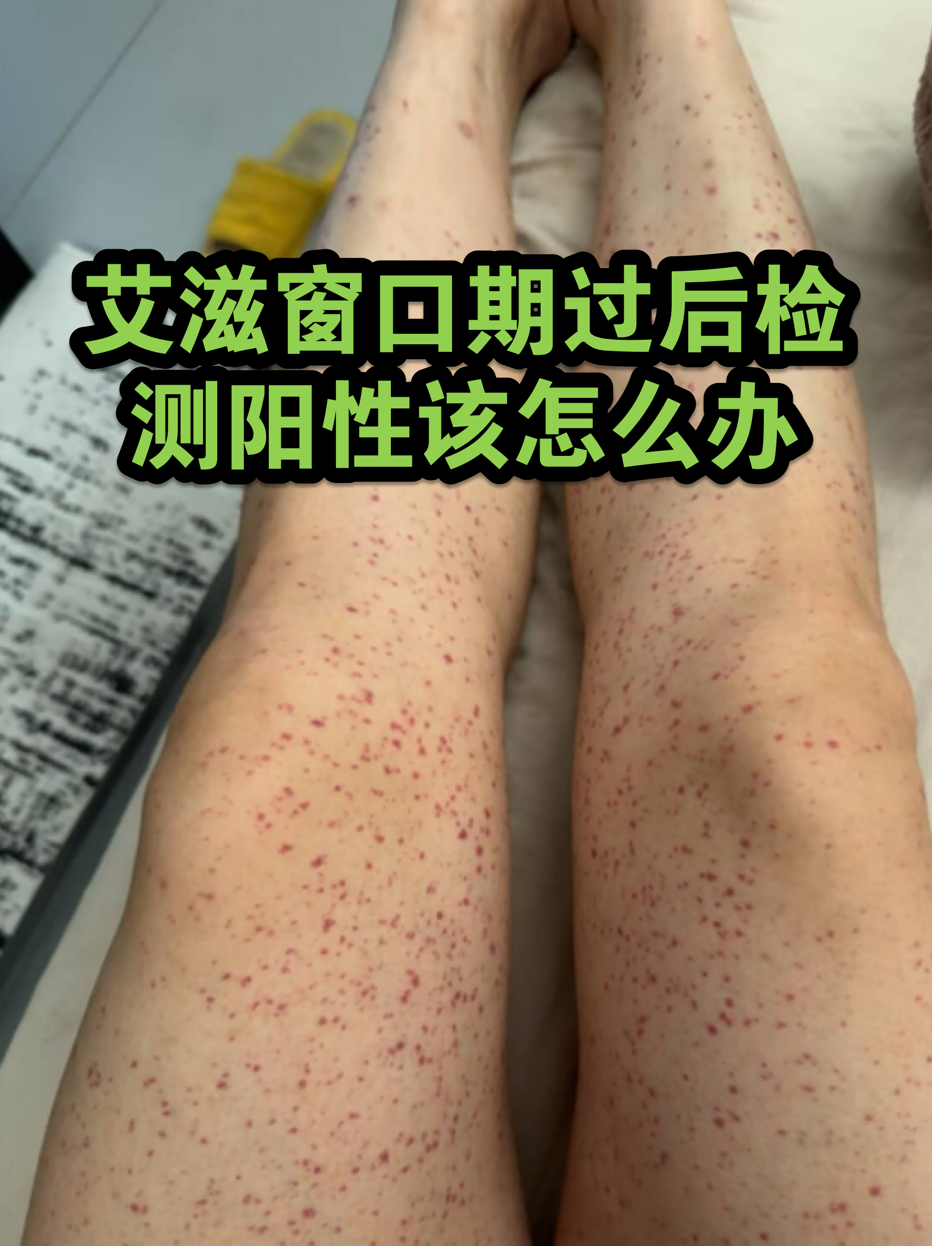 疫情阳性感染报告地区/阳性感染者地区