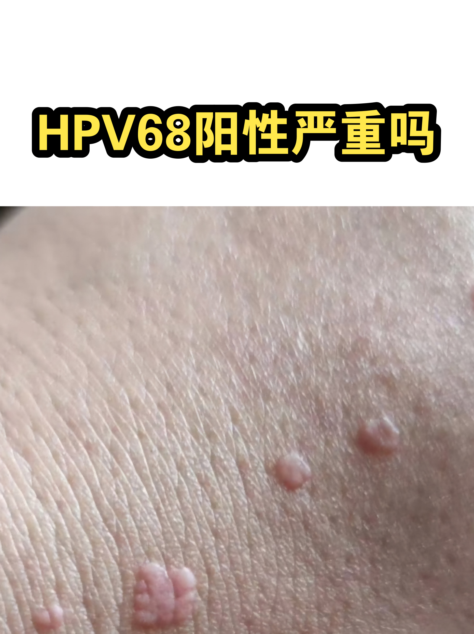 都有健康风险吗疫情地区/所有的健康-第3张图片