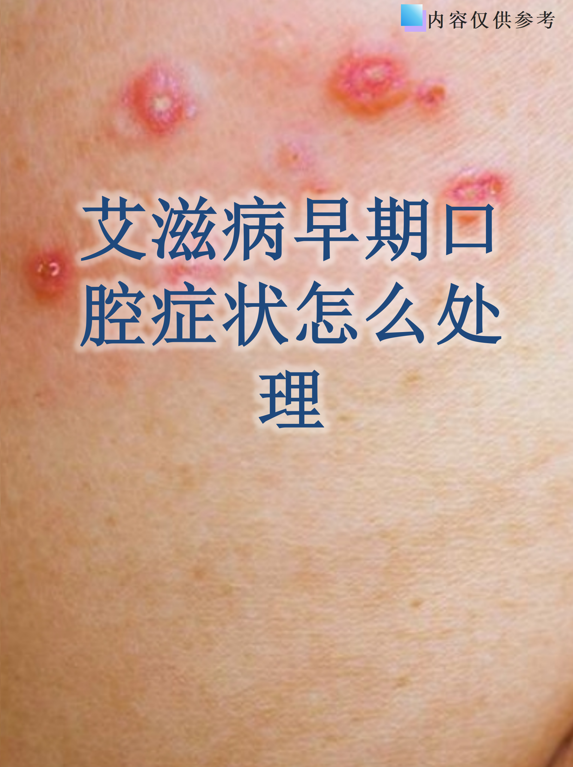 疫情最开始是什么地区/疫情最开始是什么症状-第2张图片