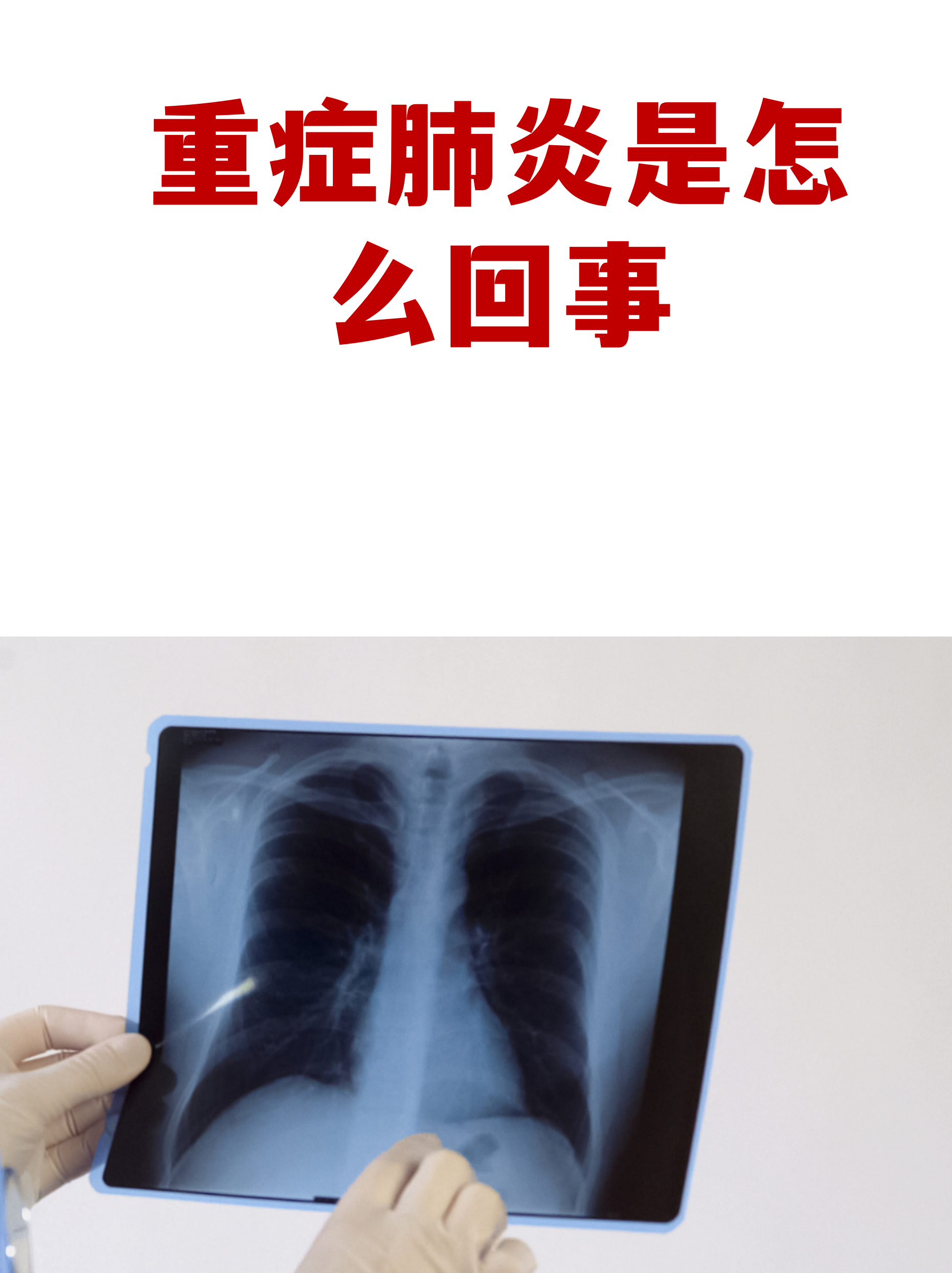 【现在深圳福田地区疫情,深圳福田有新型肺炎吗】-第1张图片