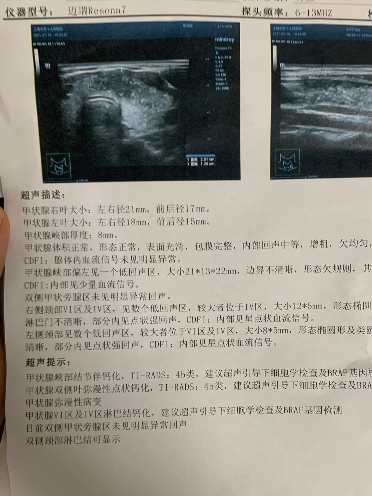 【未到达疫情地区检查什么,近期未到过疫情管控城市证明】