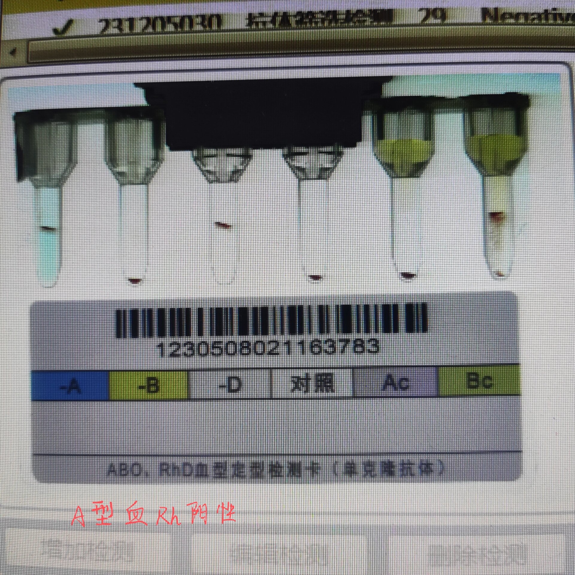 【ab类地区如何划分疫情,a类b类地区什么意思】